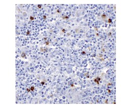 CD15 Clone MMA Pronto Para Uso - 6 Ml - Easypath - EP-12-50496